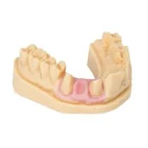 Resina para Impressora 3D Dima Print Gingiva Mask 1Kg