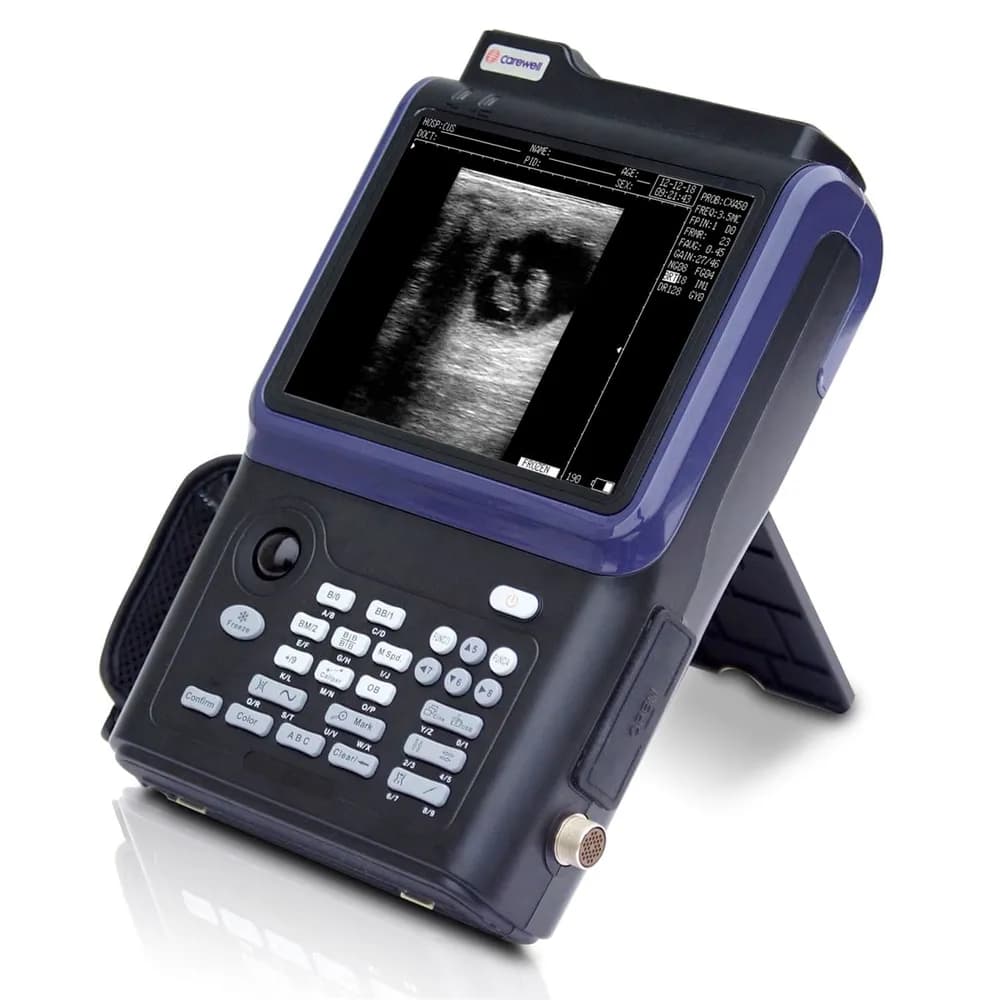 Aparelho de Ultrassom Digital C3 - Carewell