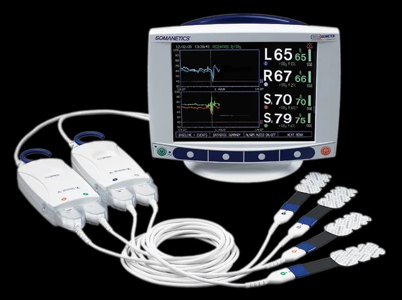 INVOS™ - Monitor da perfusão cerebral