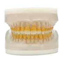 Refil Periodontia I AC 104
