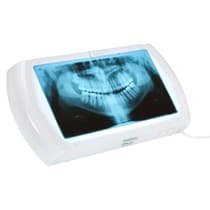 Negatoscópio Slim LED Panorâmico - Biotron