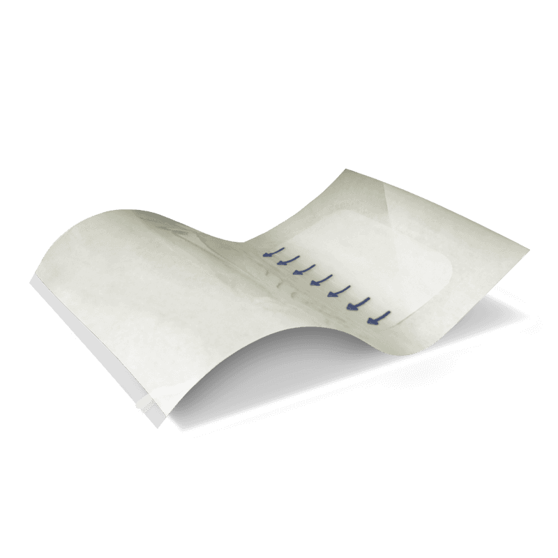 Wound Care F Filme Transparente Estéril