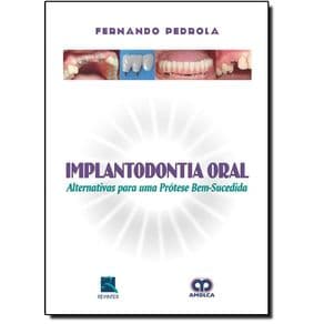 Livro - Implantodontia Oral - Alternativa para uma Prótese - Pedrola - 1ª edição - Portal do Médico