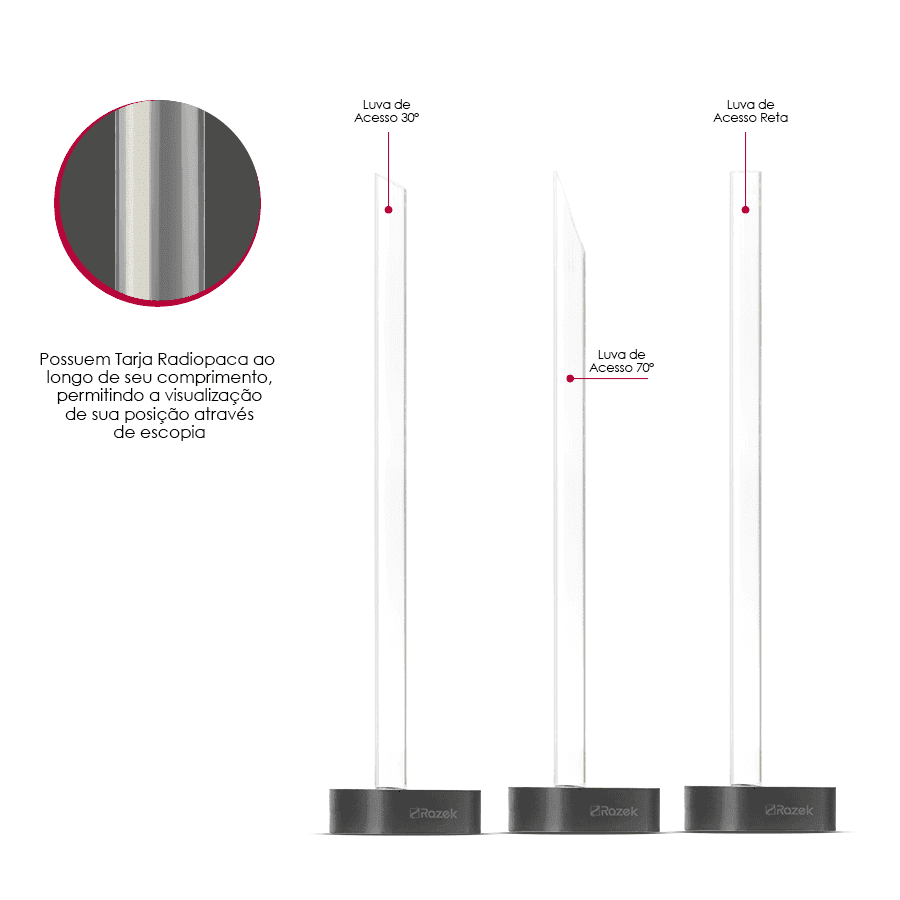 Inside Vision