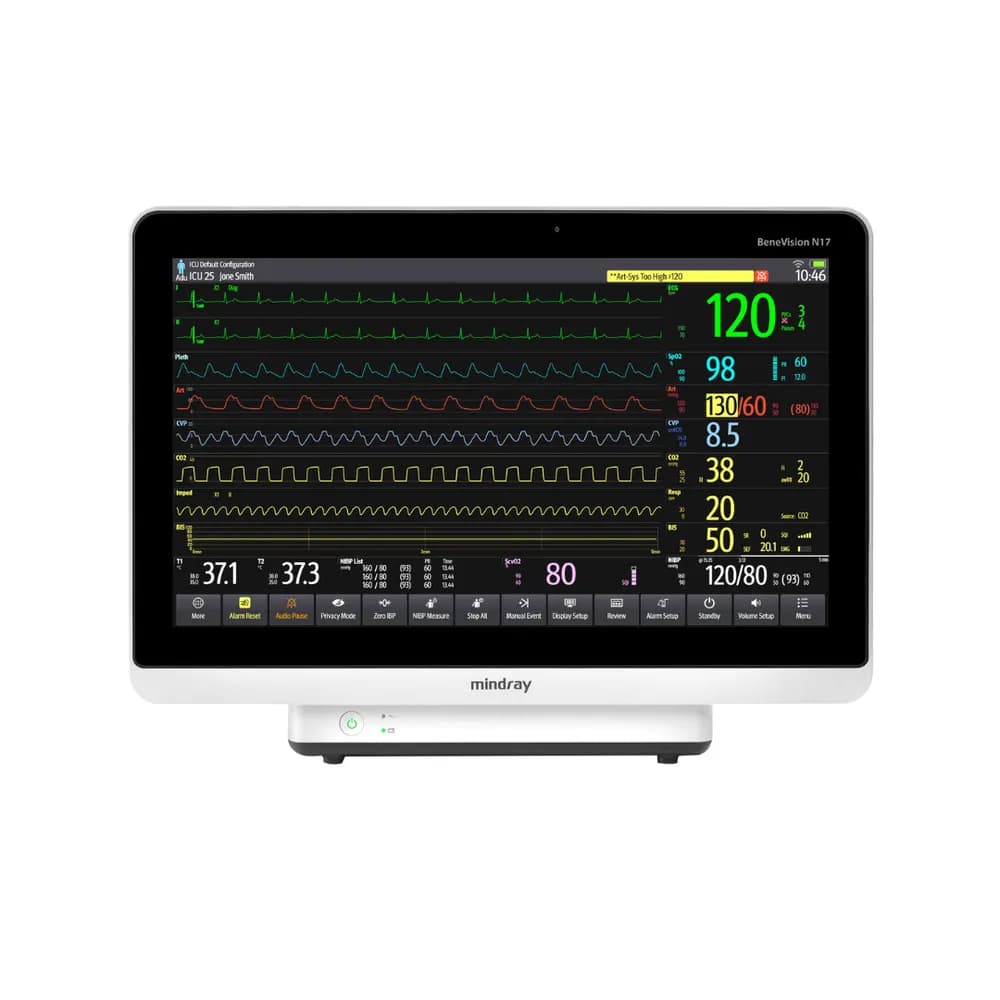 Monitor Mindray Benevision N17/N15/N12 - Monitoramento avançado de pacientes