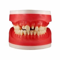 Refil Manequim Materiais Dentarios Ac100 - Pronew