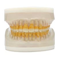Refil Periodontia I AC 104 - Pronew