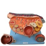 Ovário Ampliado Clássico -Anatomic - Portal do Médico