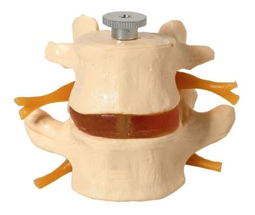 Vértebras Lombares 2 Peças, Anatomia - Portal do Médico