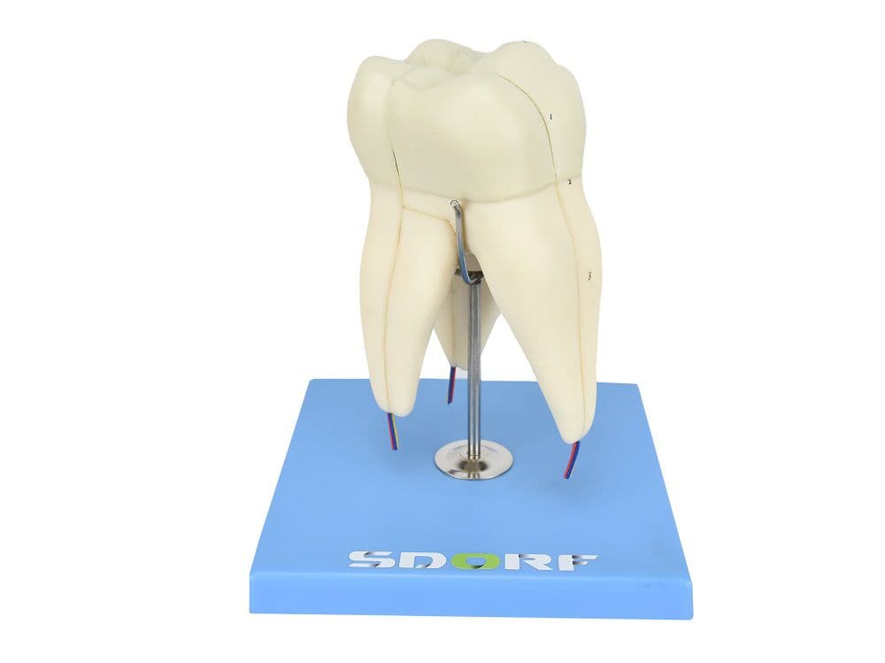 Dente Molar Superior c/ Raiz Tripla em 3 Partes, 8x o Tamanho Real - Portal do Médico