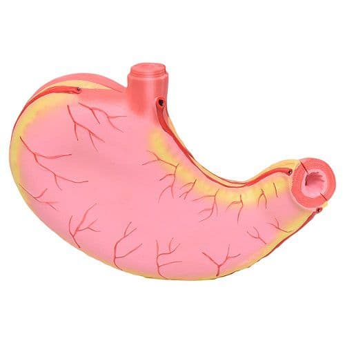 Estômago Ampliado em 2 Partes, Anatomia - Portal do Médico