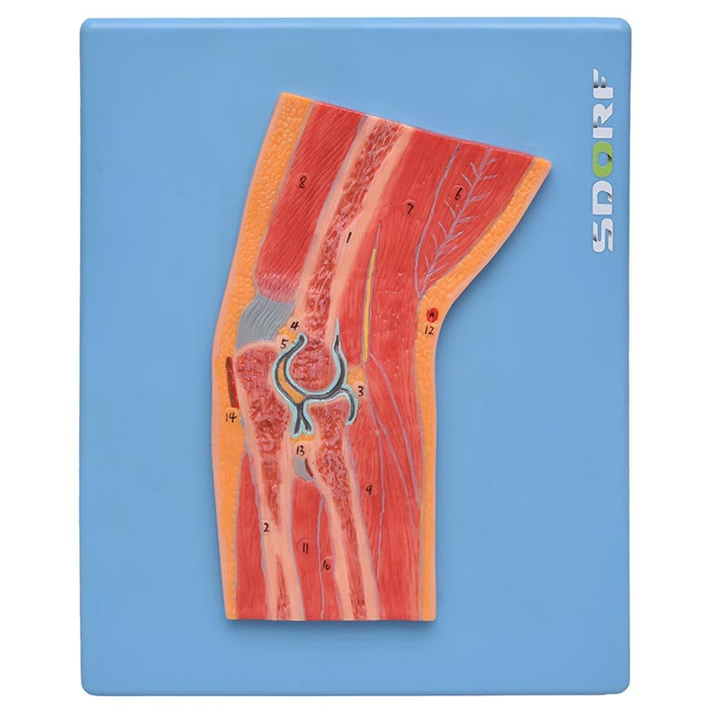 Secção Mediana da Articulação do Cotovelo Modelo Anatomia - Portal do Médico