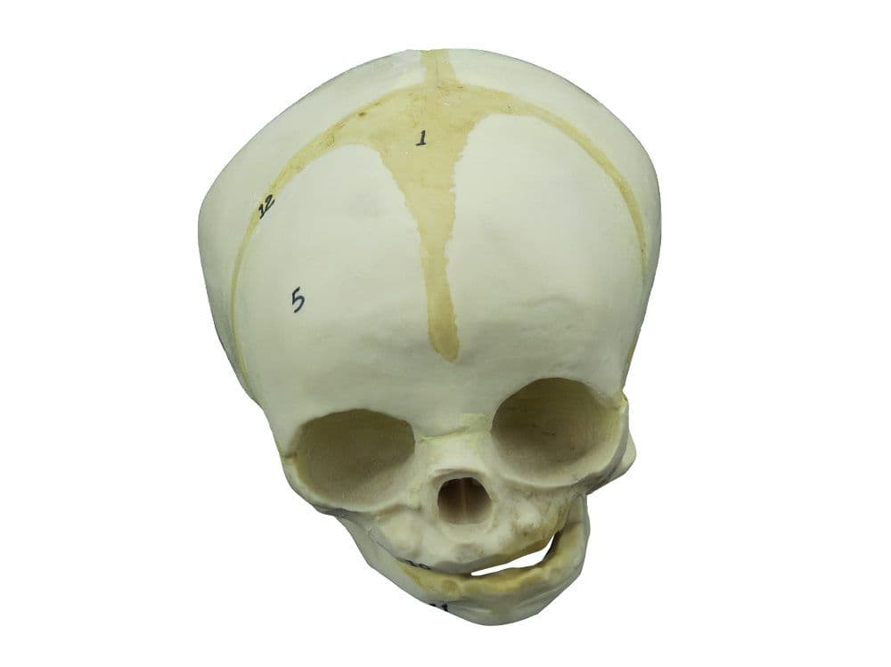 Crânio Humano Fetal - Portal do Médico