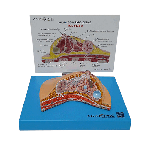 Mama dissecada com Patologias, Anatomia - Portal do Médico