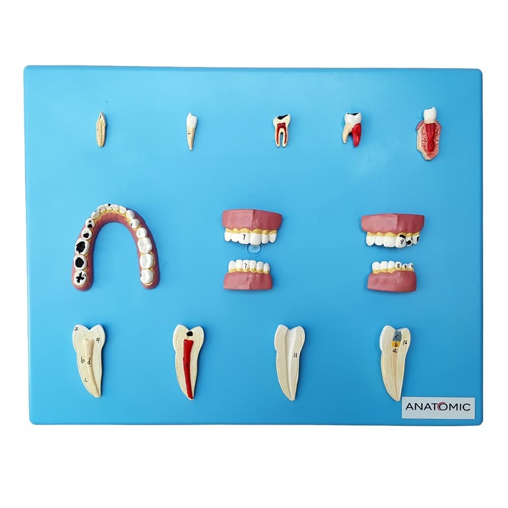 Placa com Doenças Dentárias 12 Peças Modelo Anatomia - Portal do Médico