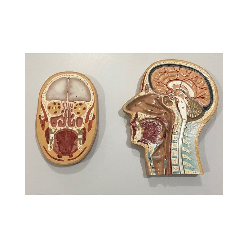 Cabeça em Corte Sargital e Frontal - Portal do Médico