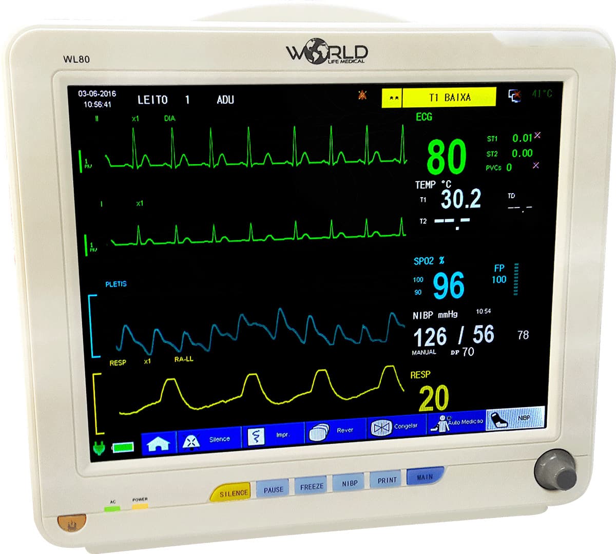 Monitor Multiparamétrico / Sinais Vitais 15" (ECG/SPO2/RESP/TEMP/PNI) - Portal do Médico