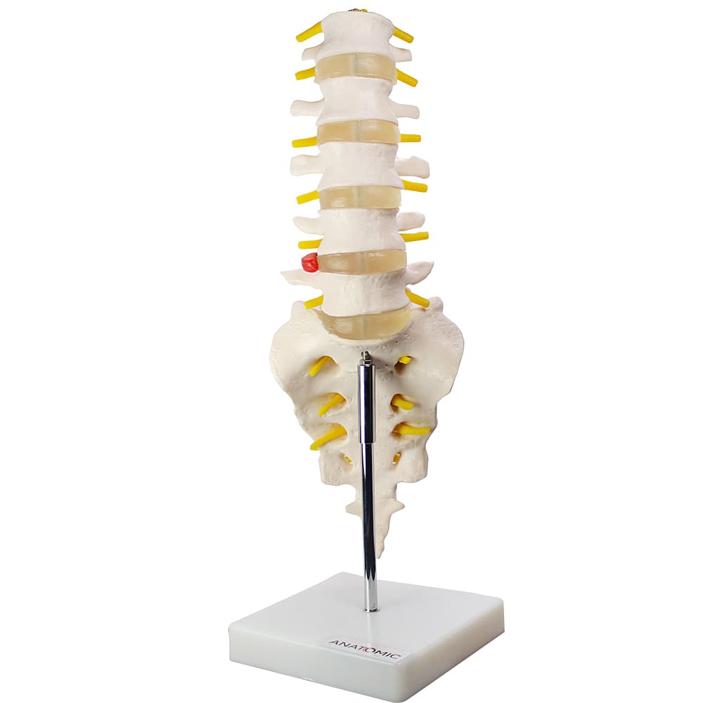 Coluna Vertebral Lombar Tgd-0145-B Anatomic - Portal do Médico