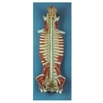 Sistema de Medula Espinhal com Cordão NEW - Anatomic - Portal do Médico