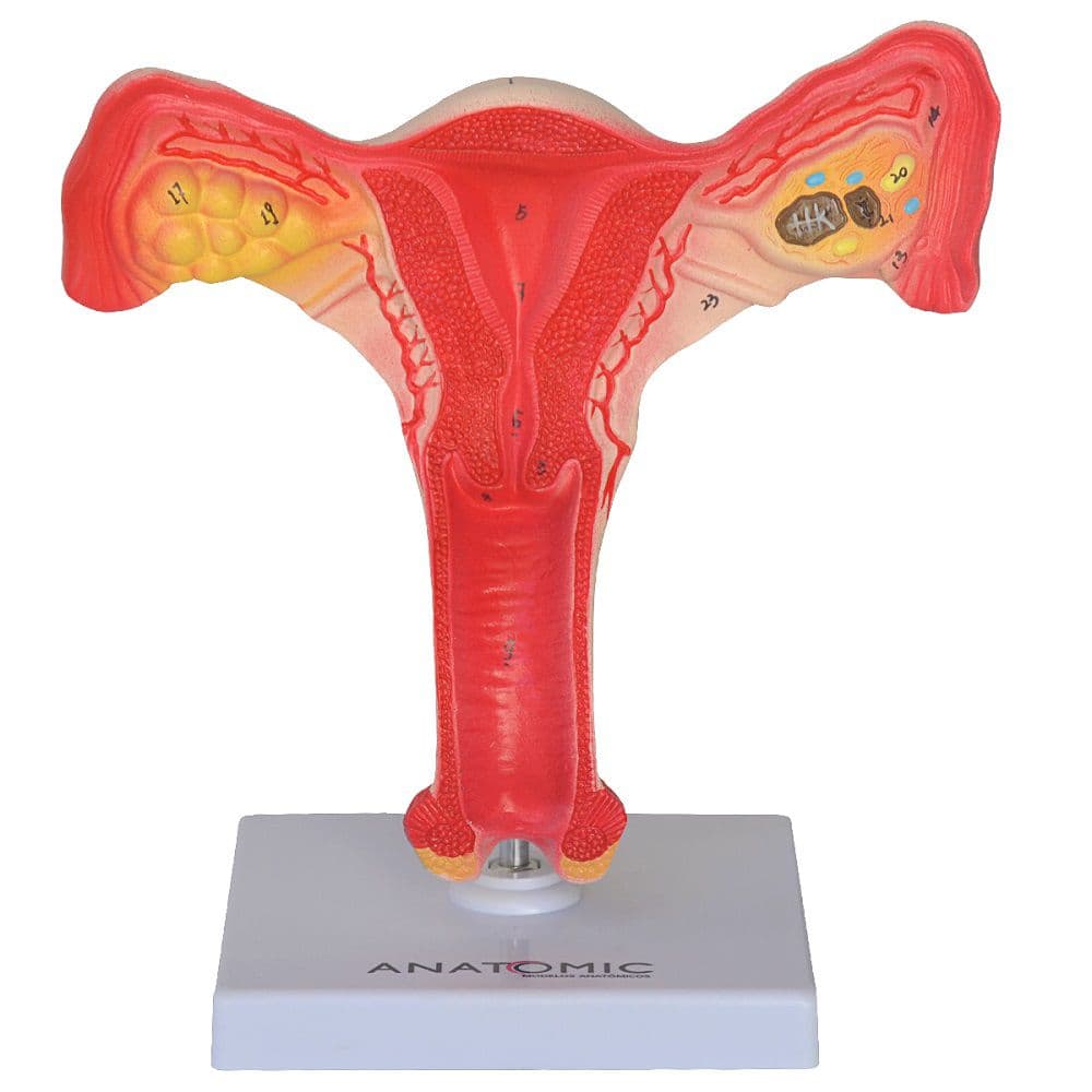 Útero c/ Trompas em Tam. Natural Modelo Anatomia - Portal do Médico