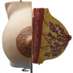 Glândula Mamária com Lactação NEW -Anatomic - Portal do Médico